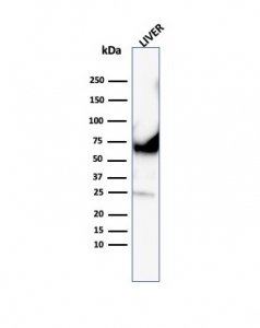 Western blot testing of human liver lysates using recombinant Albumin antibody (clone ALB/6413R). Predicted molecular weight ~69 kDa.