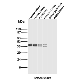 Recombinant AMACR / p504S Antibody Kidney Tissue WB. Western blot analysis of human, mouse, rat, hamster, guinea pig, and rabbit kidney tissue lysates using recombinant AMACR / p504S Antibody clone rAMACR/6369 demonstrates bands at approximately 40-42 kDa, consistent with the predicted molecular weight of Alpha-methylacyl-CoA racemase / AMACR. Similar cross-species banding patterns support recognition of this peroxisomal and mitochondrial metabolic enzyme involved in branched-chain fatty acid and bile acid metabolism. Doublet formation observed in selected species may reflect isoform variation or post-translational modification.