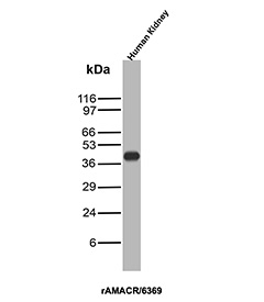 Recombinant AMACR / p504S Antibody Human Kidney WB. Western blot analysis of human kidney tissue lysate using recombinant AMACR / p504S Antibody clone rAMACR/6369 demonstrates a distinct band at approximately 40-42 kDa, consistent with the predicted molecular weight of Alpha-methylacyl-CoA racemase / AMACR. The observed signal supports expression of this peroxisomal and mitochondrial metabolic enzyme involved in branched-chain fatty acid and bile acid metabolism within renal tissue.