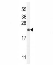 RPEL1 antibody western blot analysis in mouse liver tissue lysate