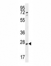 RPEL1 antibody western blot analysis in K562 lysate