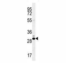 CT45A antibody western blot analysis in K562 lysate~