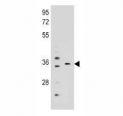 KCNRG antibody western blot analysis in mouse liver, lung tissue lysate