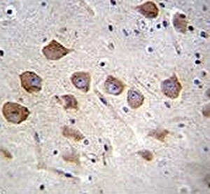KCNRG antibody analysis in formalin fixed and paraffin embedded human brain tissue.~