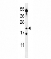 CT45A antibody western blot analysis in T47D lysate