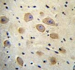 LOC339742 antibody analysis in formalin fixed and paraffin embedded human brain tissue.