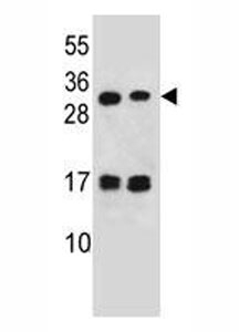 LOC339742 antibody western blot analysis in 293, Jurkat lysate