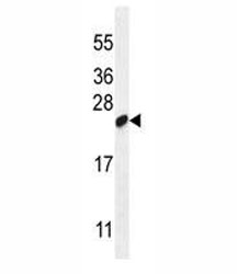 LOC147646 antibody western blot analysis in WiDr lysate.