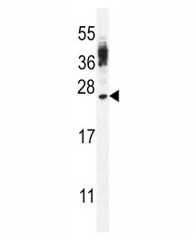 CT45A antibody western blot analysis in WiDr lysate