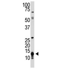 The SUMO1 antibody used in western blot to detect SUMO1 in human HL-60 cell lysate