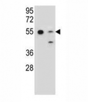 GNAS antibody western blot analysis in 293, NCI-H292 lysate. Predicted molecular weight ~46kDa.