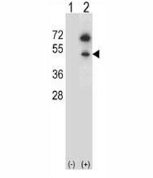 Western blot analysis of GNAS antibody and 293 cell lysate (2 ug/lane) either nontransfected (Lane 1) or transiently transfected (2) with the GNAS gene.