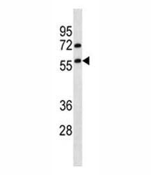 TRIM13 antibody western blot analysis in HepG2 lysate.