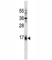Puma antibody western blot analysis in A549 lysate. Predicted molecular weight: 21kDa.