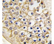 IHC analysis of FFPE human testis tissue stained with TRPV3 antibody