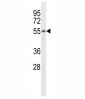 PGA3 antibody western blot analysis in MDA-MB231 lysate.