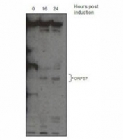 HHV8 ORF57 antibody western blot analysis. ORF57 expressed from an inducible virally infected B-cell line, TREx BCBL 1-Rta.
