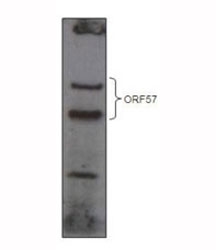 HHV8 ORF57 antibody western blot analysis of over-expressed GFP-tagged ORF57 in HEK293T cell line.~