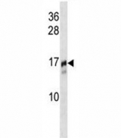 TRAPPC2 antibody western blot analysis in NCI-H292 lysate.
