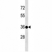 TSPY3 antibody western blot analysis in 293 lysate.