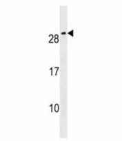 CFC1B antibody western blot analysis in NCI-H292 lysate