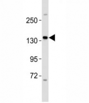 Western blot testing of ERBB4 antibody at 1:2000 dilution + MCF-7 lysate; Predicted molecular weight: 147-180 kDa (precursor), 120, 80 kDa (cleaved forms).