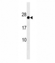 GAGE12F antibody western blot analysis in HepG2 lysate