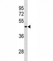 RBMY1A1 antibody western blot analysis in NCI-H292 lysate.