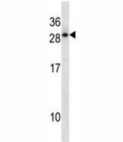 HOXD12 antibody western blot analysis in A549 lysate. Predicted molecular weight: ~29kDa.
