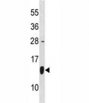HSP10 antibody western blot analysis in HepG2 lysate. Expected molecular weight: ~10kDa.