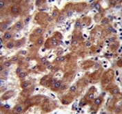 Androgen Receptor antibody (ANDR) immunohistochemistry analysis in formalin fixed and paraffin embedded human liver tissue.