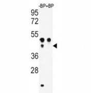 Western blot analysis of ATF4 antibody pre-incubated without (Lane 1) and with (2) blocking peptide in WiDr lysate