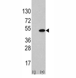 Western blot analysis of ATF4 antibody and 293 cell lysate (2 ug/lane) either nontransfected (Lane 1) or transiently transfected with the ATF4 gene (2).~