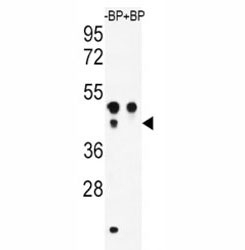 Western blot analysis of ATF4 antibody pre-incubated without (Lane 1) and with (2