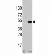 Western blot analysis of ATF4 antibody and 293 cell lysate (2 ug/lane) either nontransfected (Lane 1) or transiently transfected with the ATF4 gene (2).