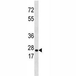 ERAB antibody western blot analysis in 293 lysate~
