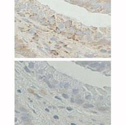 IHC analysis of FFPE human prostate tissue. (Top) Staining with the ERAB antibody at a 1:20 concentration. (Bottom) Staining is blocked wtih the immunizing peptide. Data and protocol c