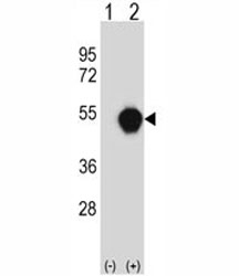 Western blot analysis of PXK antibody and 293 cell lysate (2 ug/lane) either nontransfected (Lane 1) or transiently transfected (2) with the PXK gene.