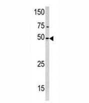 Western blot analysis of PXK antibody and HeLa lysate. Expected molecular weight: 51-65 kDa (three isoforms).