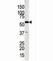 Glycerol kinase 2 antibody used in western blot to detect GK2 in Jurkat lysate