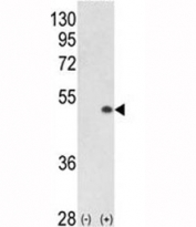 Western blot analysis of PCTAIRE1 antibody and 293 cell lysate (2 ug/lane) either nontransfected (Lane 1) or transiently transfected with the PCTK1 gene (2).