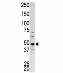 Western blot analysis of PCTAIRE1 antibody and HepG2 lysate~