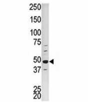 Western blot analysis of PCTAIRE1 antibody and HepG2 lysate