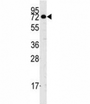 Western blot analysis of CASC3 antibody and NCI-H460 lysate