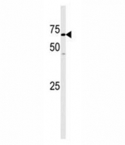 Western blot analysis of GAK antibody and mouse heart tissue lysate