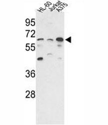 Western blot analysis of PPP3CC antibody and HL-60, Jurkat, A375 lysate.~