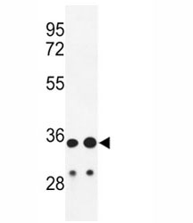 Western blot analysis of IGH antibody and HL-60, A2058 lysate.