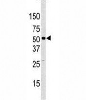 Western blot analysis of JMJD2D antibody and HeLa lysate