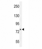 FBXL10b western blot analysis in mouse bladder tissue lysate