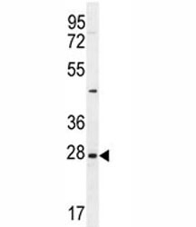 EDN3 antibody western blot analysis in NCI-H460 lysate
